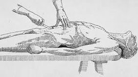 Timeline: Antecedentes históricos de la Medicina Forense