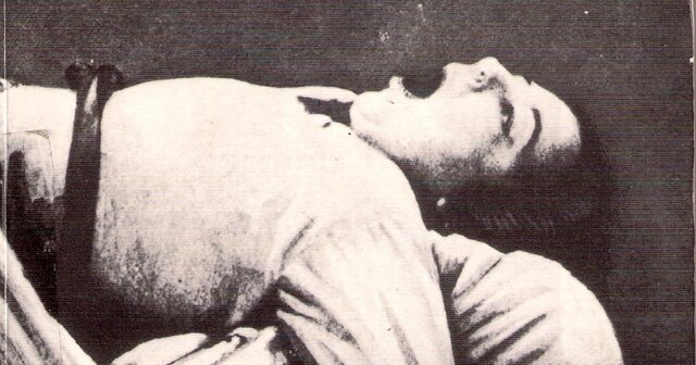 Estudio comparativo de las parálisis motrices orgánicas e histéricas