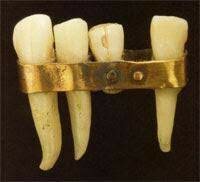 800 A.C: Inicio de los implantes dentales.