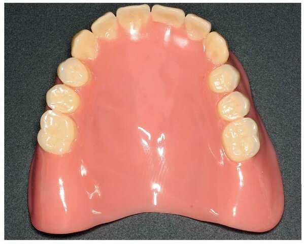 1935: Resina acrilica