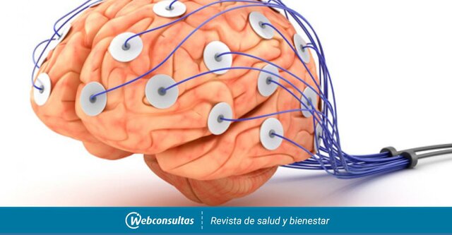 Estímulos Eléctricos