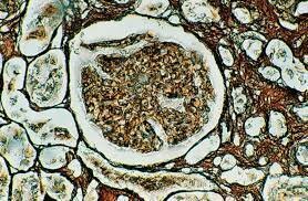 Golgi,Ramón y Cajal