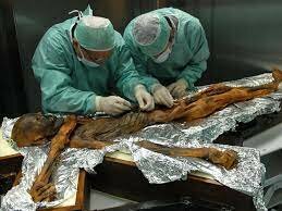 Research found how Otzi died