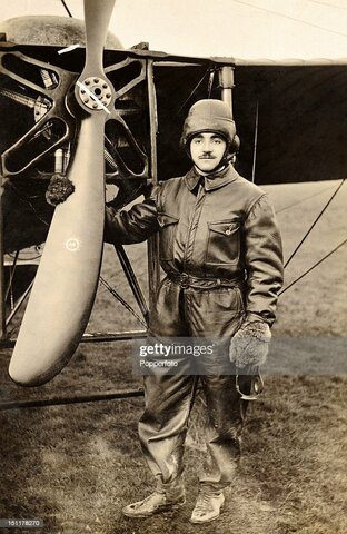 Primera prótesis de aluminio