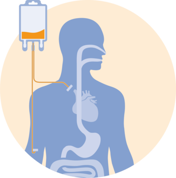 Alimentación endovenosa