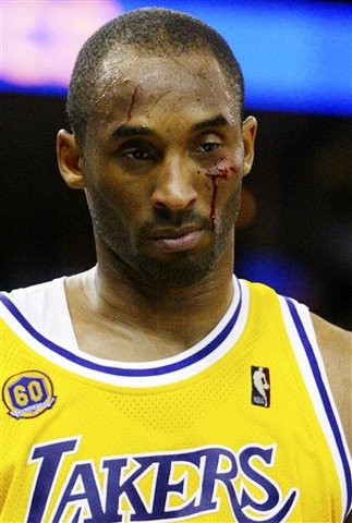 Kobe Bryant agrees to overseas deal