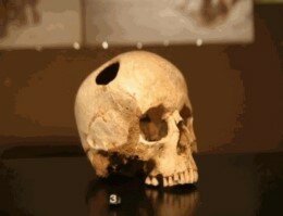 Antecedentes sobre las discapacidades