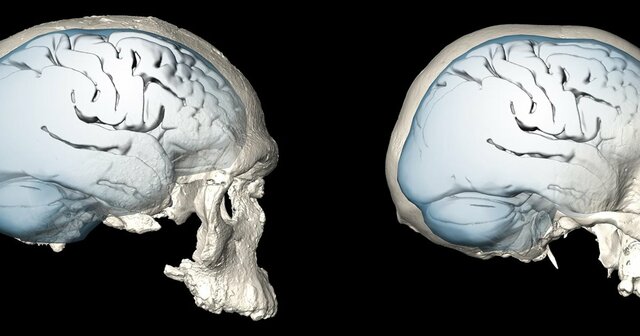 CARACTERISTICAS DEL CEREBRO (HACE 10000ac