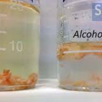 Timeline: ALCOHOL Y ETER