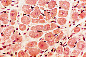Magnitudes, unidades y limitación de dosis de radiación