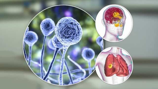 Teoría microbiana sin Pasteur y Robert Koch