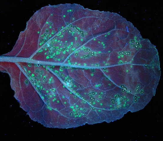 ● LA TEORÍA MICROBIANA