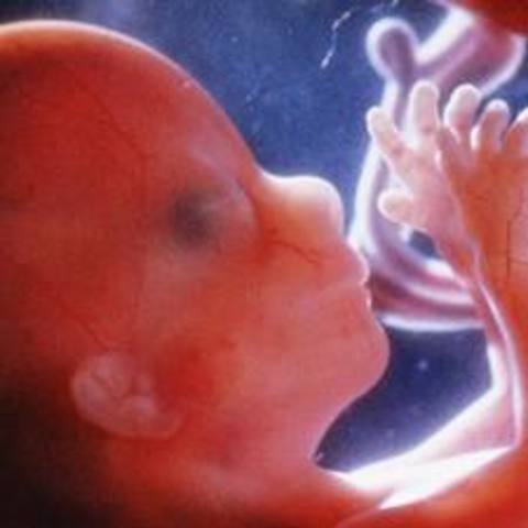 Brain outside of Sam's head