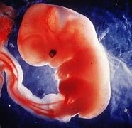 SEGUNDO MES DE EMBARAZO