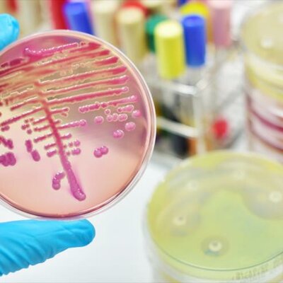 Timeline: Desarrollo histórico de la microbiología aplicada