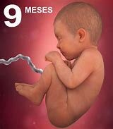 NOVENO MES DE EMBARAZO