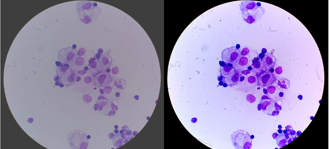 Contribuciones de Kohler: radiaciones UV