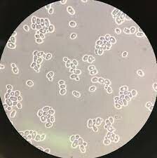 Invención del microscopio de contraste de fase