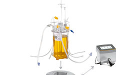 Timeline: Desarrollo histórico de Biorreactores - Chavez Ramirez