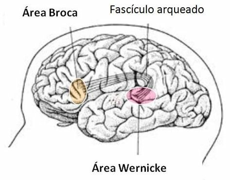 Broca