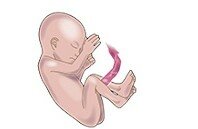 Octavo mes de embarazo