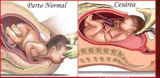 ¡¡¡Listo para nacer!!!