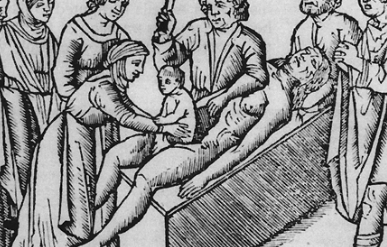 Dr. Jesse Bennet performs the fist succsesful C section