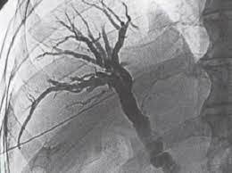 Historia de los rayos X