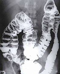 Historia de los rayos X