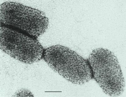 Vacuna para la Rabia