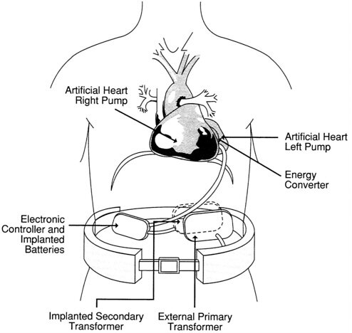 20th century (continued)