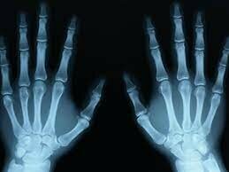 Quinto Evento los rayos X