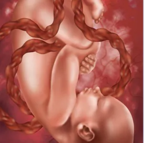 Semana 40 de embarazo