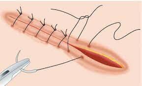 16th and 17th Centuries
