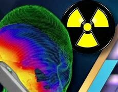 Cáncer por la exposición a radiación