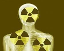 Efectos de la Radiación