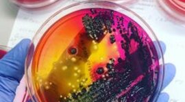 Timeline: Desarrollo histórico de los biorreactores