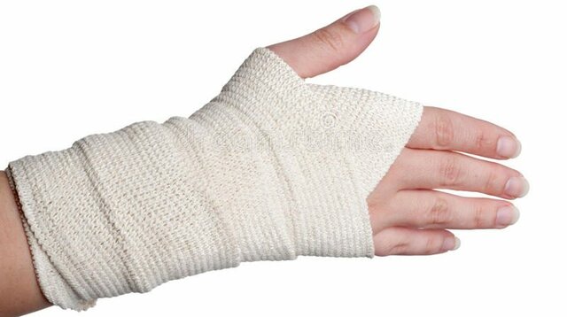 Quemadura en mi mano