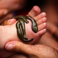 Egyptian Leech Therapy