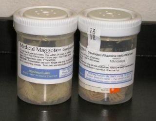 Maggot Therapy