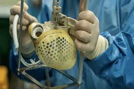 The first totally implantable artificial heart was placed in a patient in Louisville, Ky. In