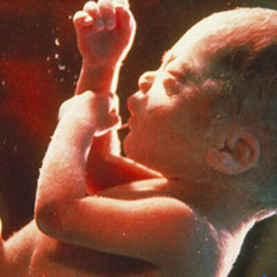 Timeline: Desarrollo Prenatal