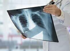 Invención de los Rayos X.