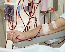 Primera Hemodiálisis exitosa en un ser Humano.