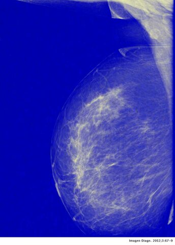 Se presenta la Xerorradiografía