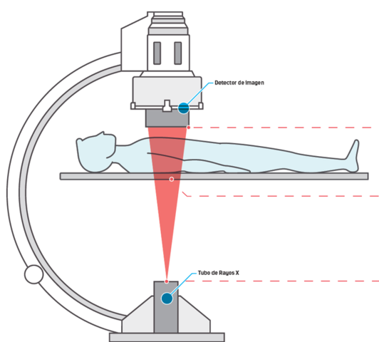 Tubo Intensificador de Imagen