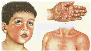 1553 BERNARDINO MONTAÑA DE MONSERRATE