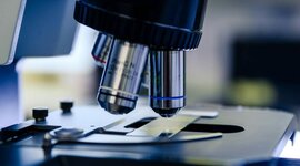 Timeline: Microscopio Óptico