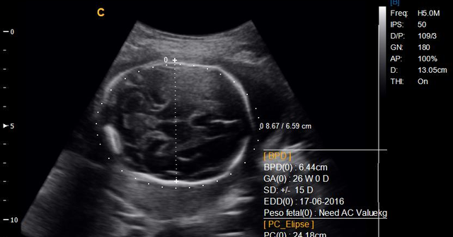 Se inicia la utilizacion habitual del diagnostico por ultrasonidos