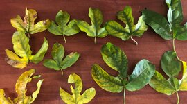 Timeline: Teoría microbiana de la enfermedad